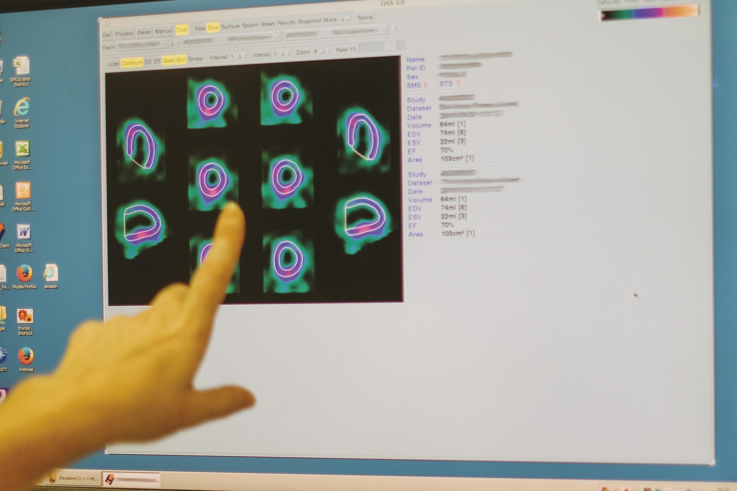 Therapeutic Radiographers Newcastle Hospitals Clinical Skills Academy