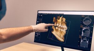 Dental cone-beam computed tomography (CBCT) combined course 3D Scanning