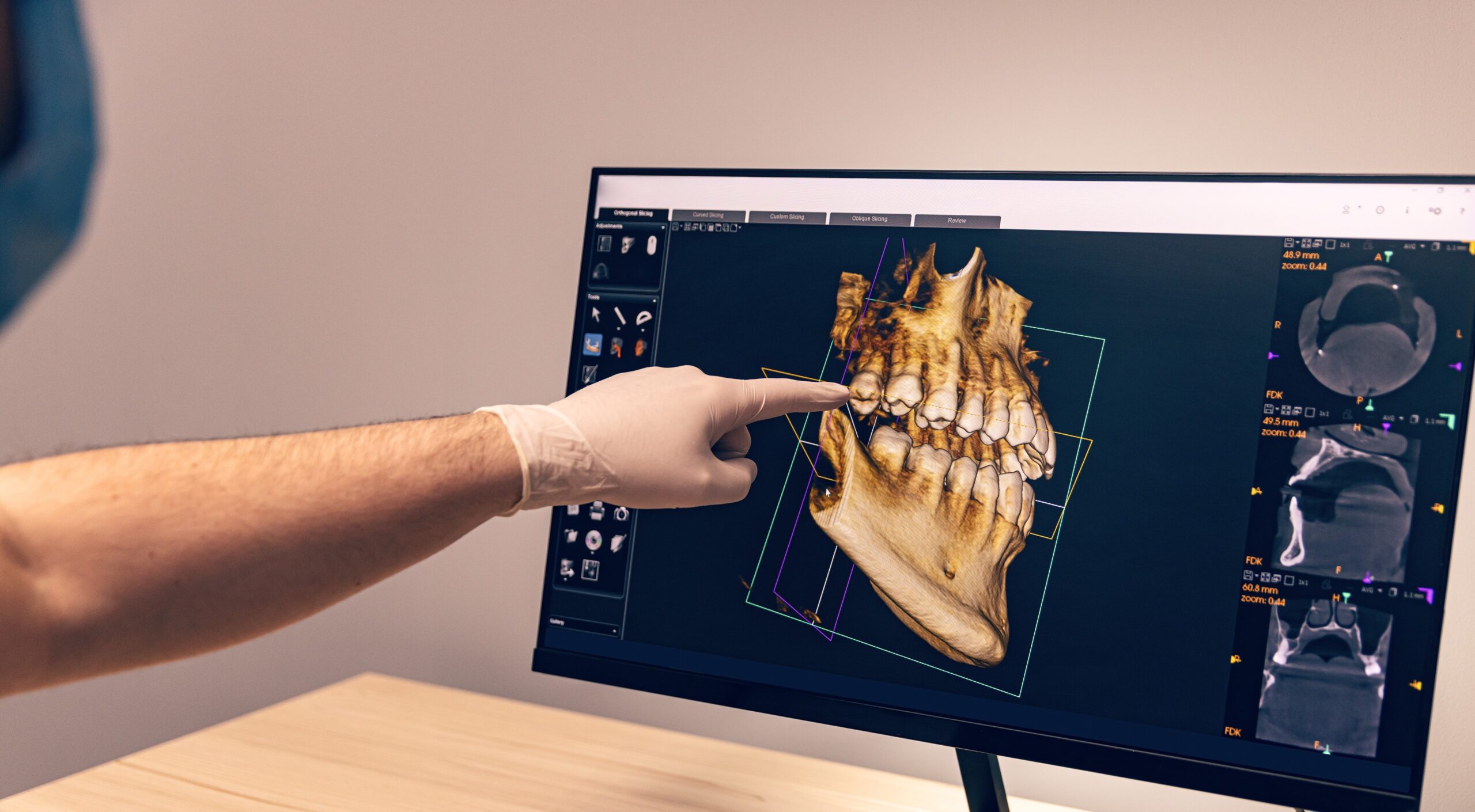 Dental cone-beam computed tomography (CBCT) combined course 3D Scanning