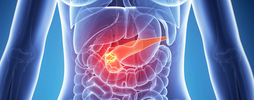 Upper GI cancers