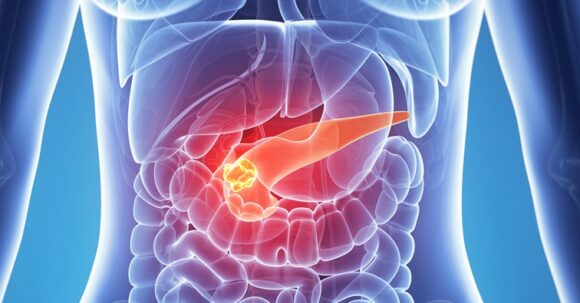 Upper GI cancers