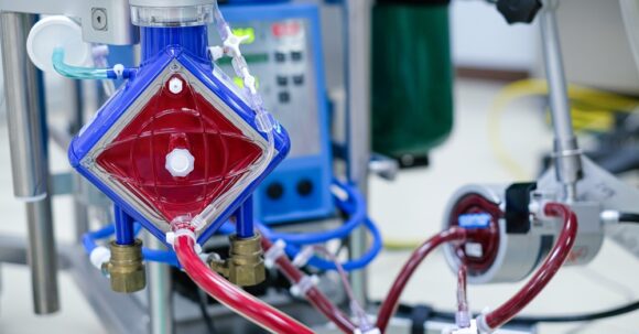 Paediatric ECMO equipment